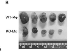 MTHFD2在通过抑制PTEN重编程巨噬细胞极化中的应用